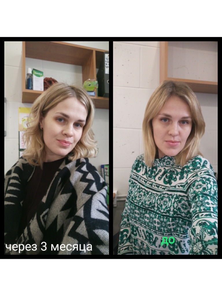 Фото в отзыве о докторе Глушко Александр Витальевич