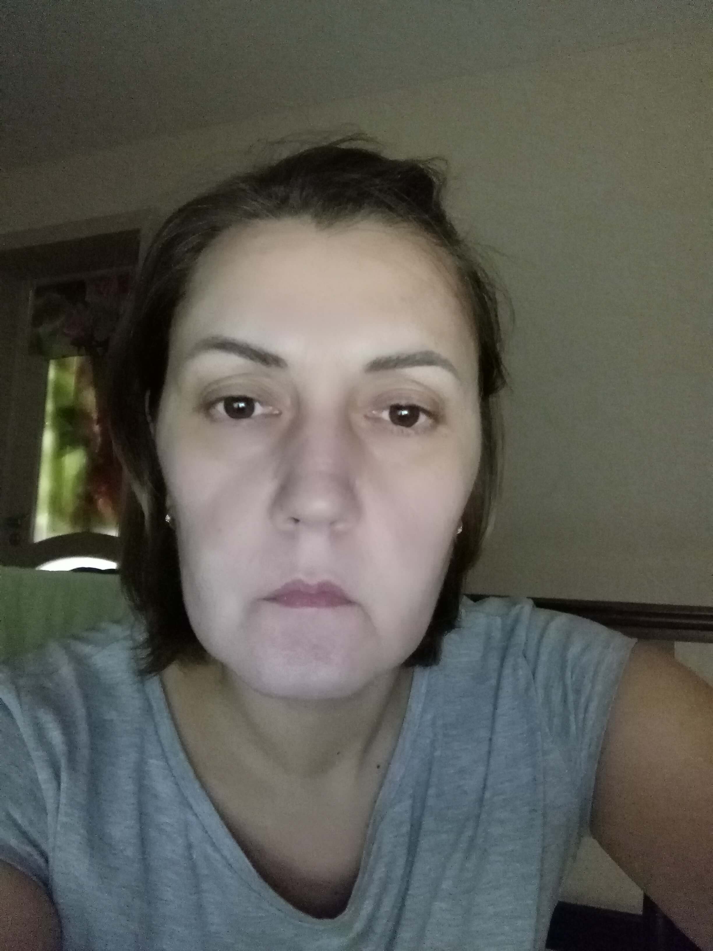 Фото 1. Инъекции филлеров и липолитиков при астме и аллергии можно сделать?