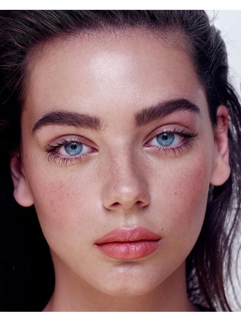 Фото 1. Чем чревато увеличение губ при ревматоидном артрите?