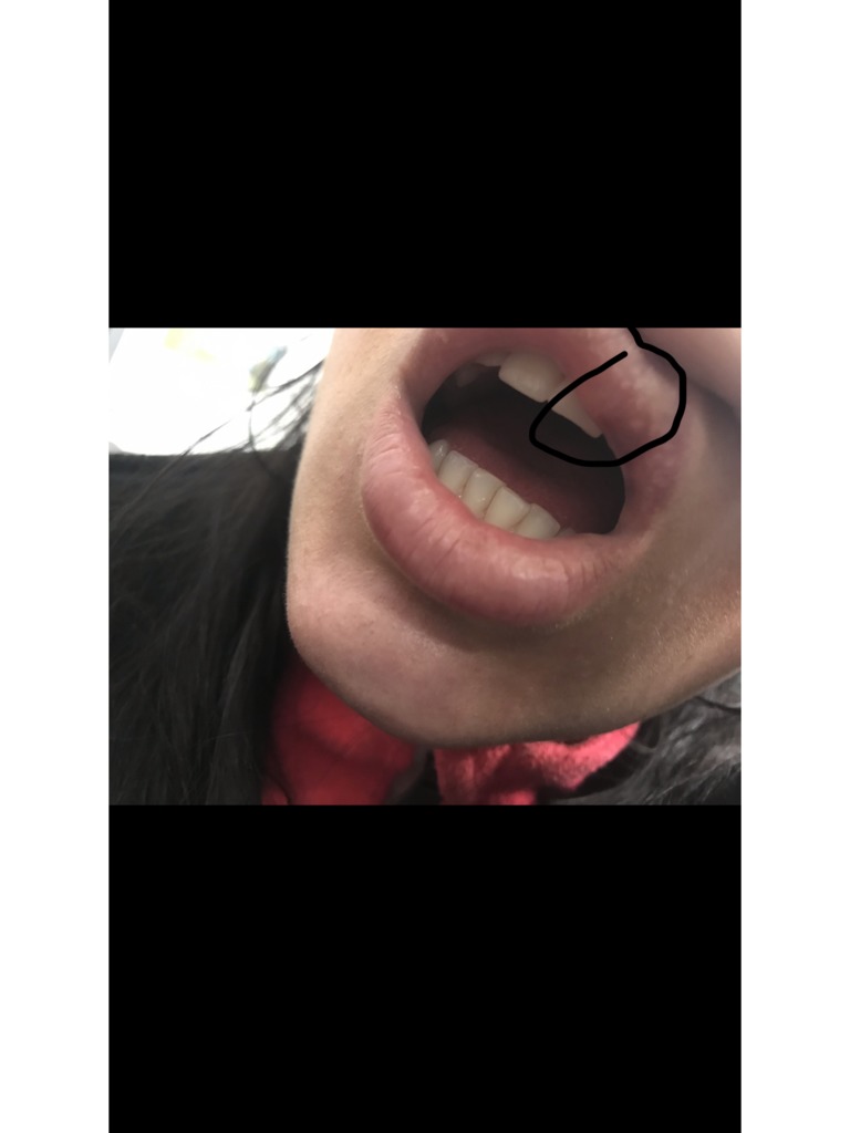 Дрожание губы у взрослых: причины появления симптома