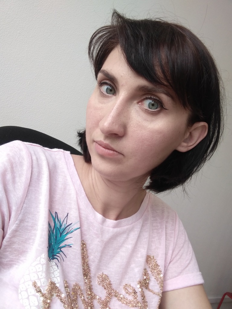 Фото 4. Нормально ли, что 3 дня отек под глазами?