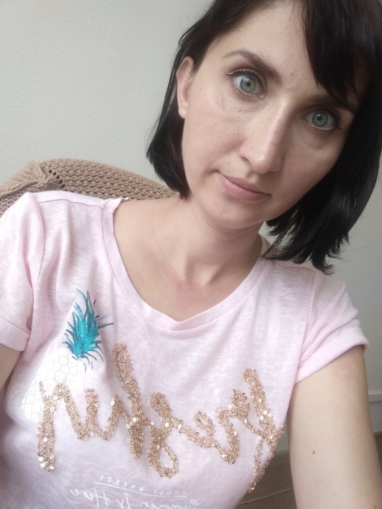 Фото 2. Нормально ли, что 3 дня отек под глазами?