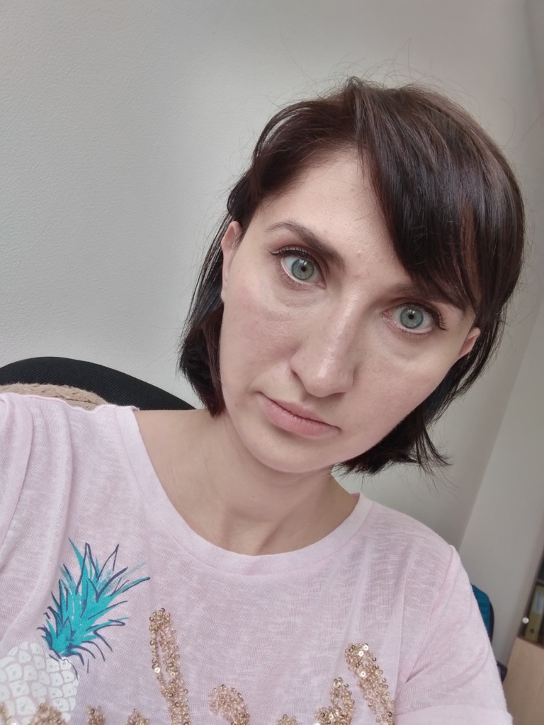 Фото 3. Нормально ли, что 3 дня отек под глазами?