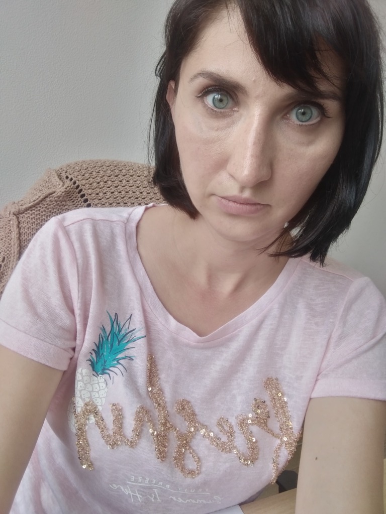 Фото 1. Нормально ли, что 3 дня отек под глазами?