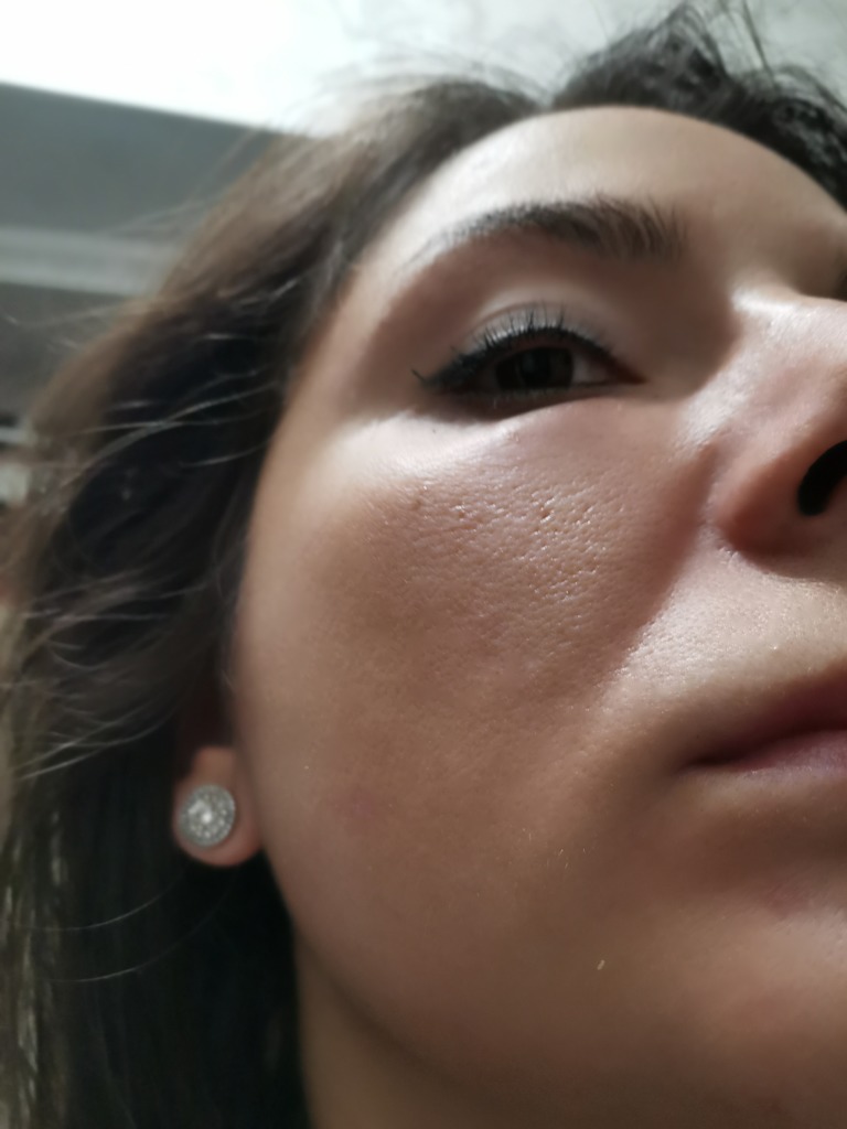 Фото 1. Может ли так долго рассасываться гель или это что-то другое?