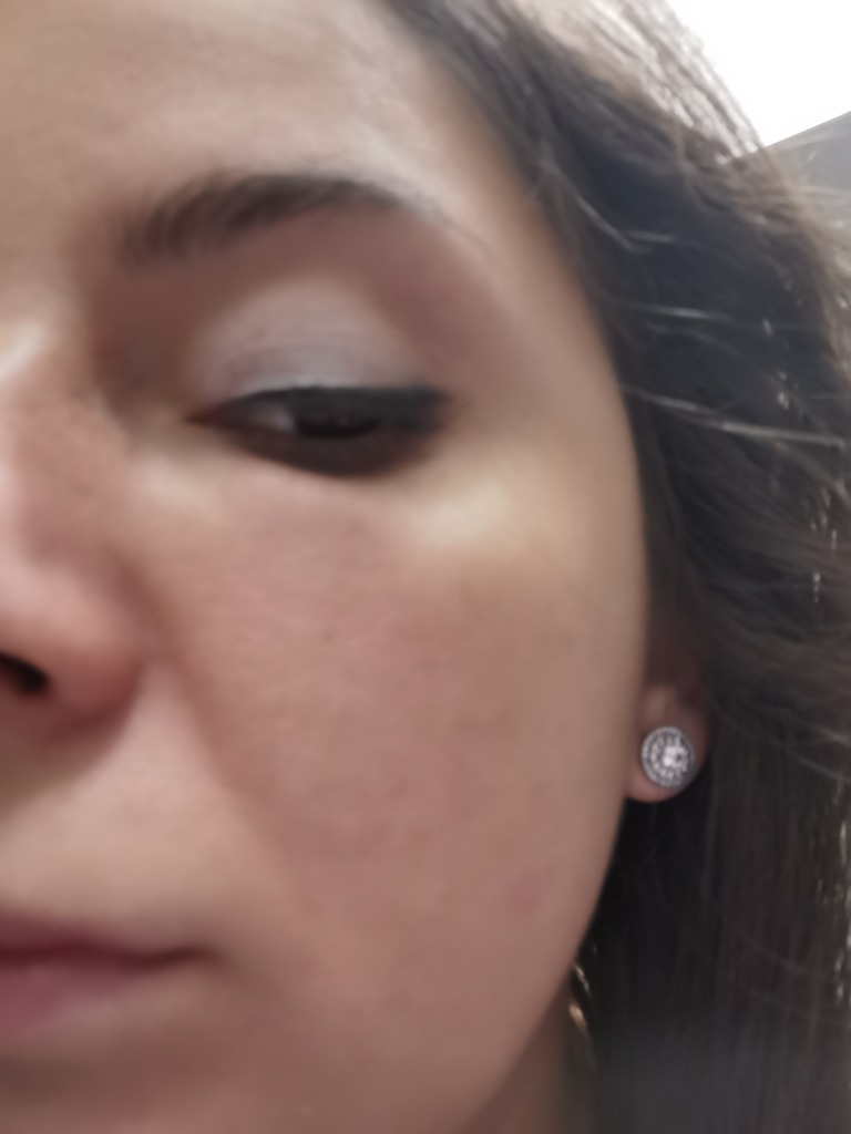 Фото 2. Может ли так долго рассасываться гель или это что-то другое?