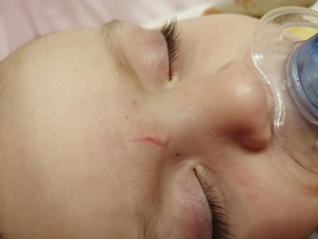 Фото 1. Стоит ли еще что-то делать, чтобы убрать твердость?