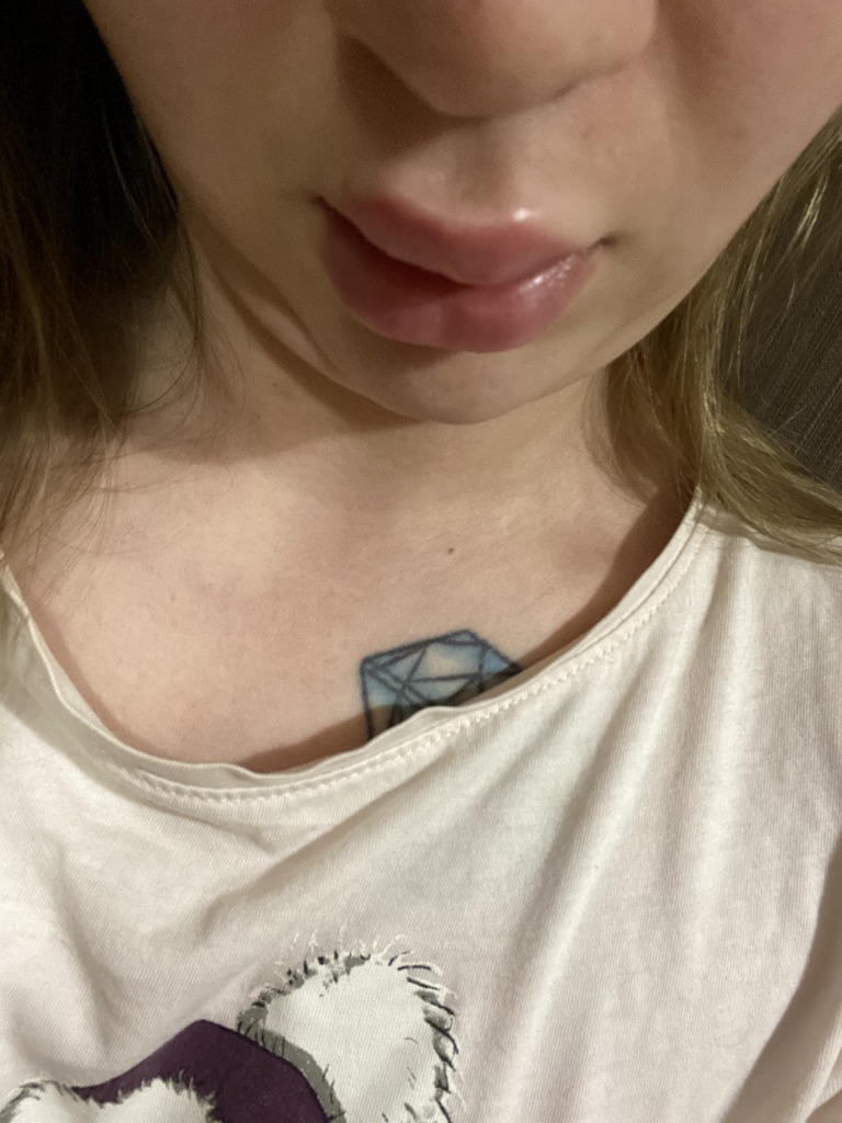 Фото 2. Не первый раз образовывается шишка после процедуры, что это может быть?