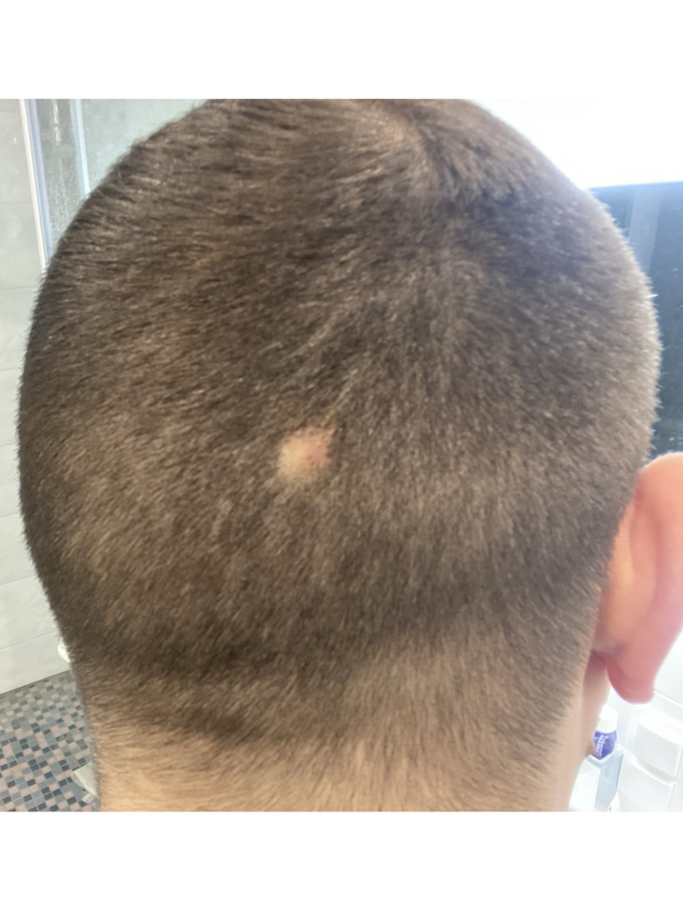 Фото 2. Как устранить данный дефект?