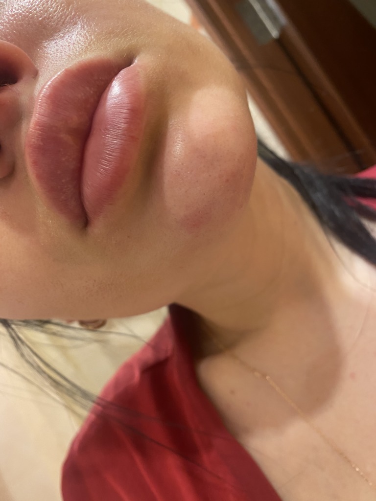 Фото 1. Можно ли к стоматологу после контурной пластики?