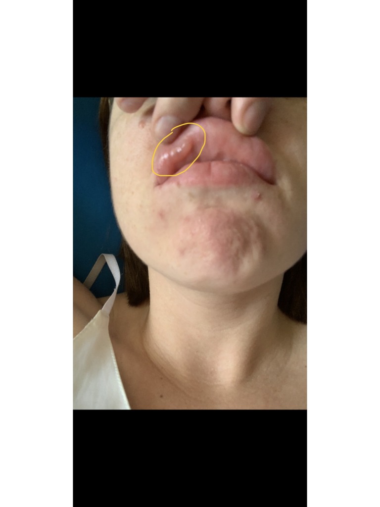 Фото 1. Опасен ли этот мешочек?