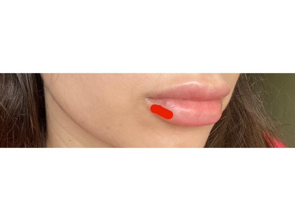 Фото 2. Скажите, пожалуйста, что это может быть?