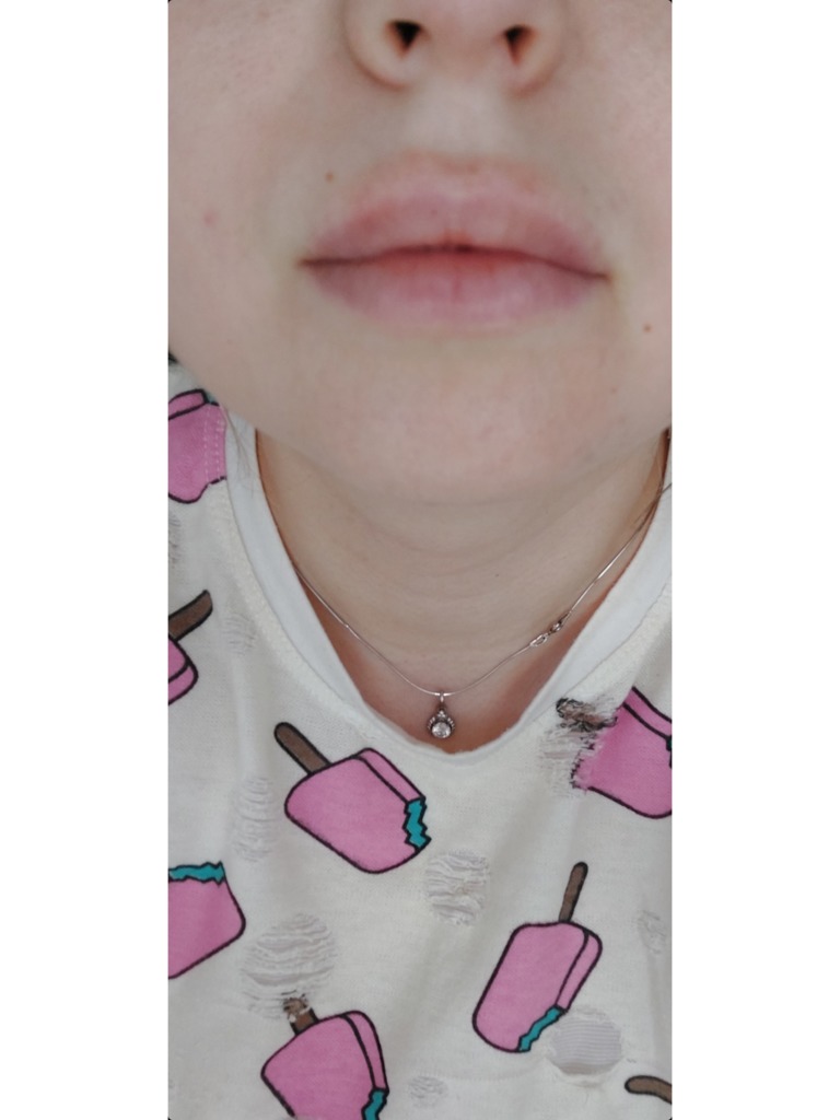 Фото 1. Что это может быть?