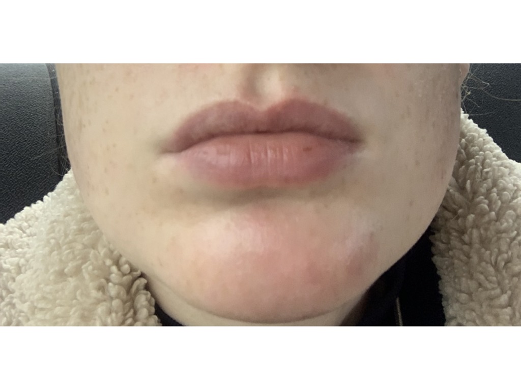 Фото 1. Возможно ли вернуть прежний вид коже?