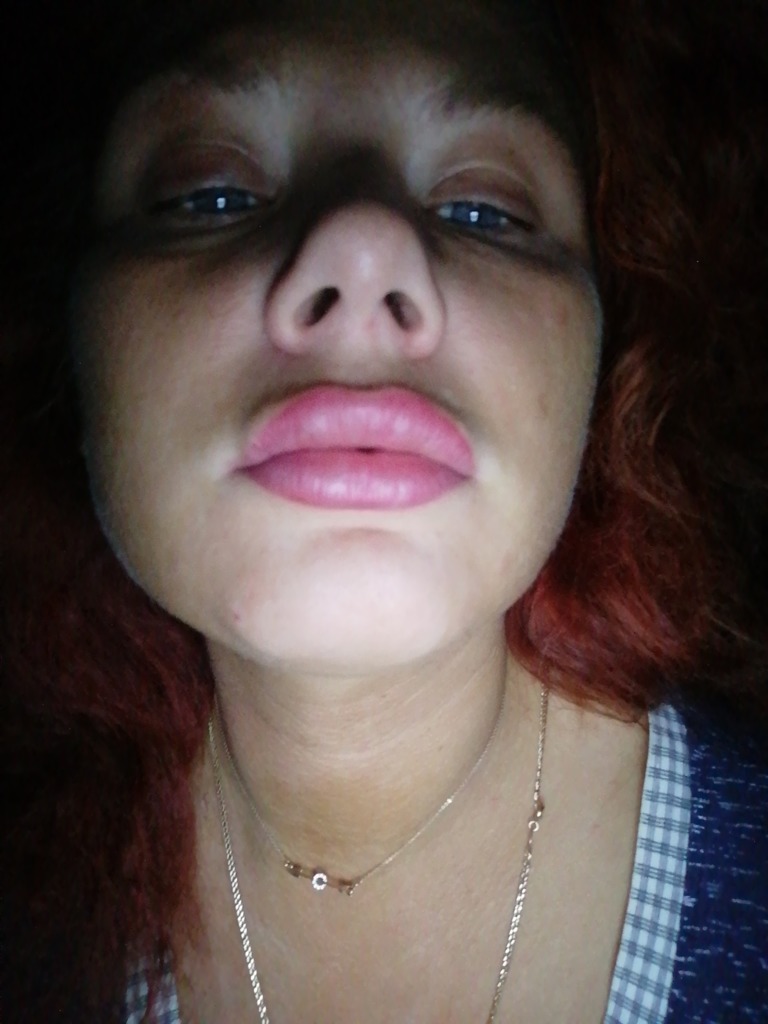 Фото 1. Пройдет ли это само и в чем причина?