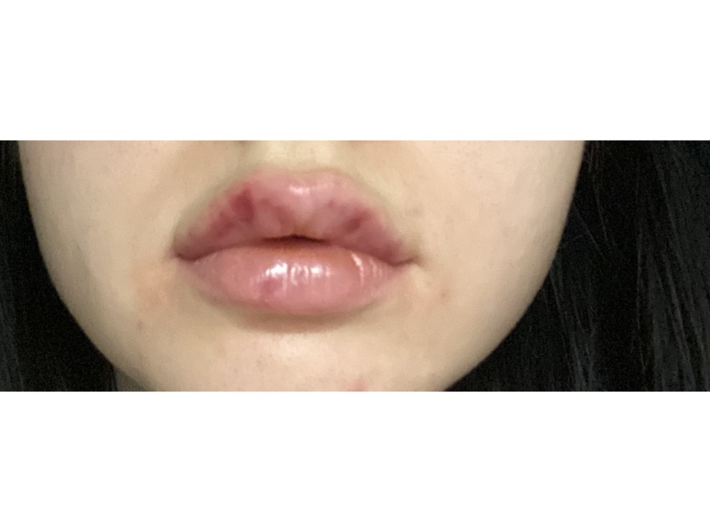 Фото 2. Уйдут ли заломы или что-то не так сделали?