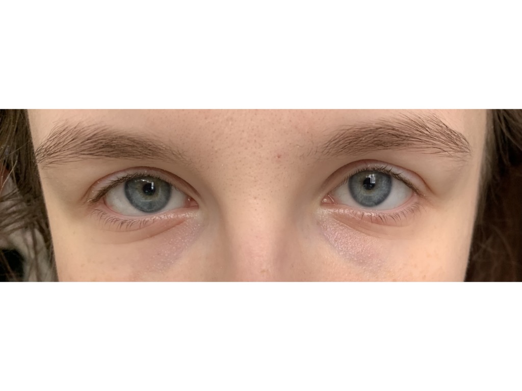 Фото 2. Посоветуйте, пожалуйста, стоит растворять препарат?