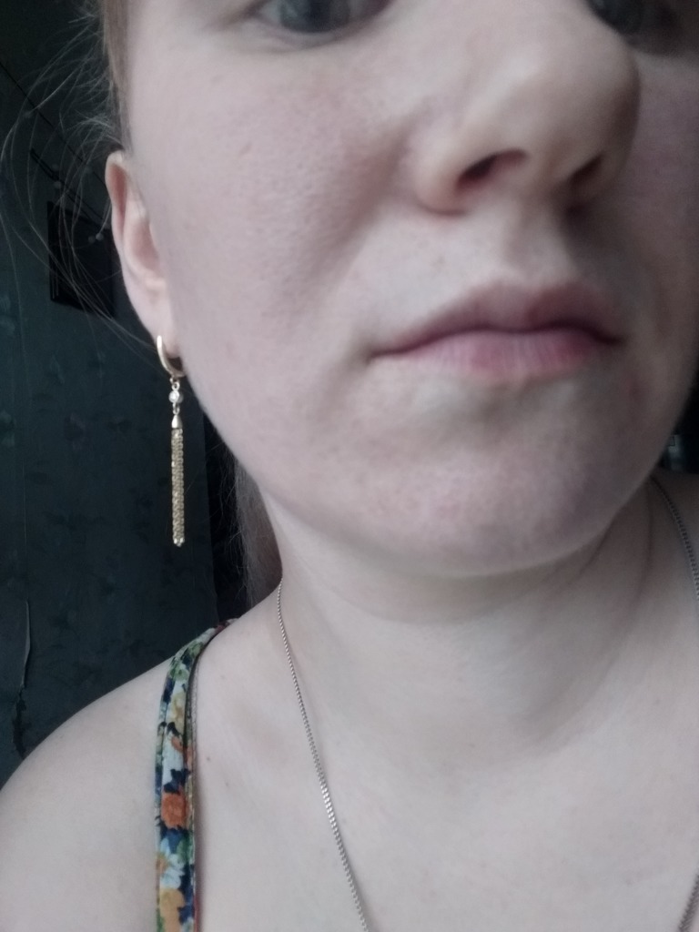 Фото 2. Что лучше СМАС или филлер?