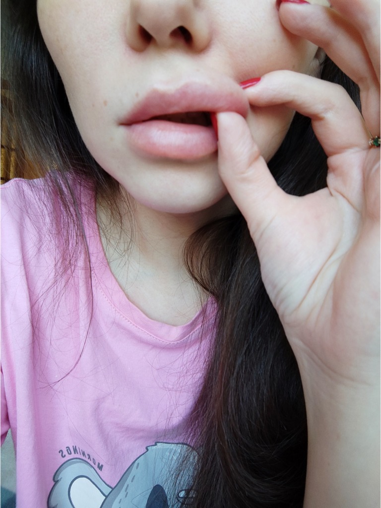 Фото 2. Нужно ликолоть лонгидазу?