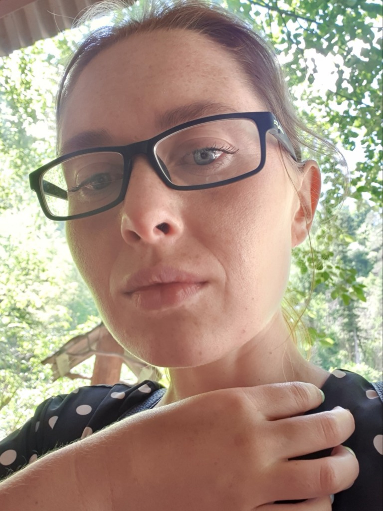 Фото 1. Носогубная складка